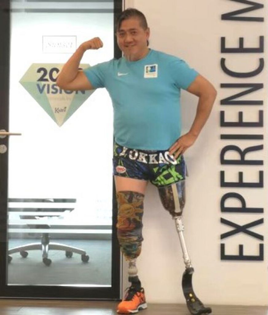 蘋果基金｜截肢者借助刀片義肢展新生 感謝蘋果基金支持