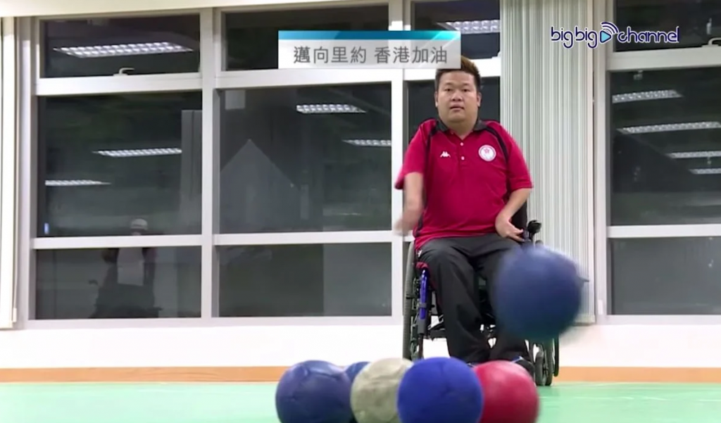 天生患病曾因被白眼感自卑 不敢见人。