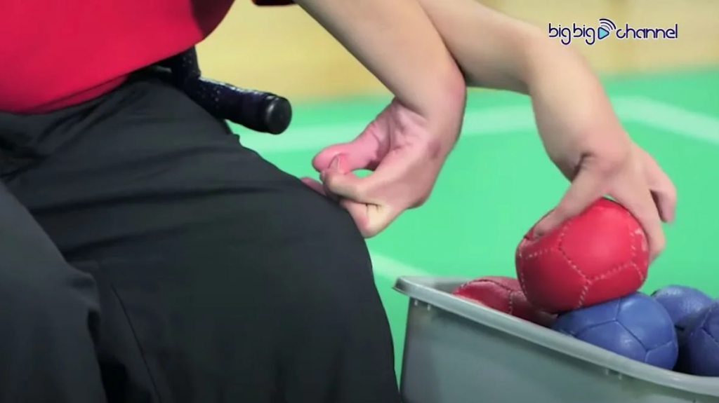 天生患病曾因被白眼感自卑 不敢见人。