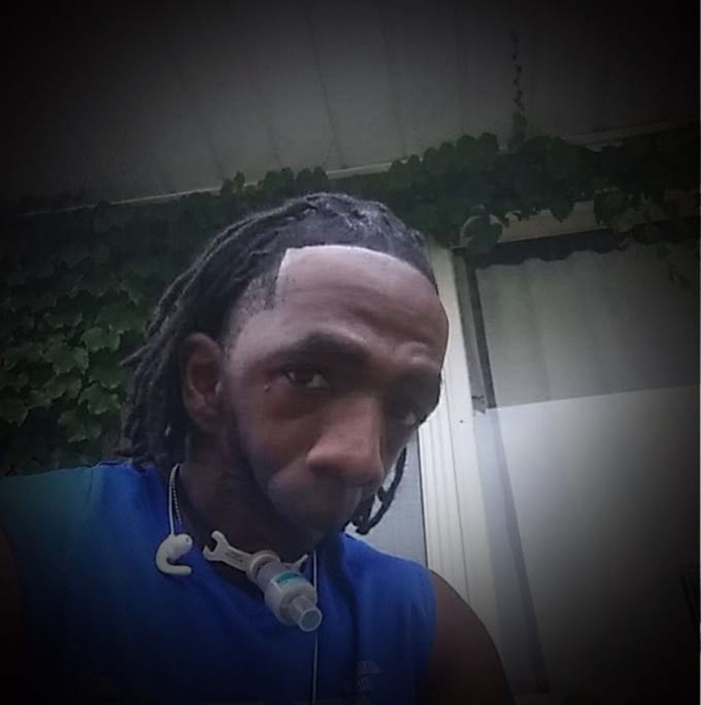 威廉斯患有有罕見病「耳面症候群」，出生時已只得半張臉，因沒有下顎而從未曾吃過東西，也無法正常呼吸及講話。